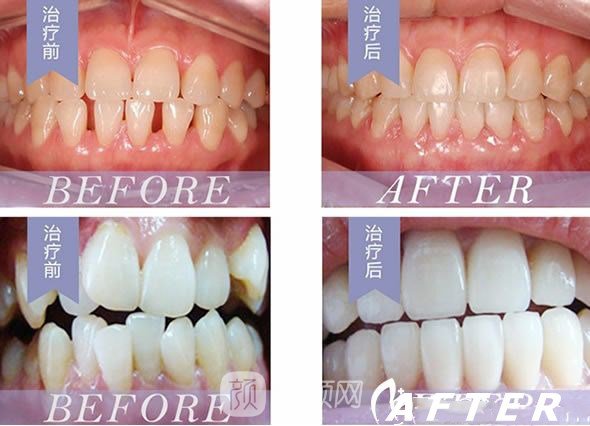 袁世伟医生案例