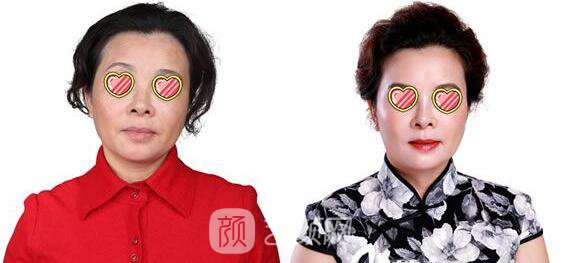 李月明医生案例