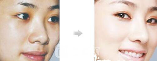 黄江泊医生案例