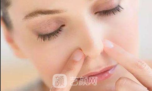 合肥瑞兰隆鼻多少钱