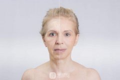 天津热玛吉紧肤价格大概多少？