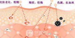 e光嫩肤一般要多少钱，影响价格的因素？