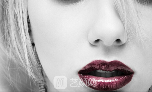 埋线提升鼻子能保持多久？是*的吗？