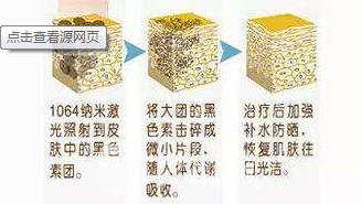 黑脸娃娃收缩毛孔果好吗?