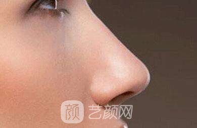 隆鼻选择什么材料好呢?