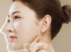 爱贝芙隆鼻手术价格多少？爱贝芙隆鼻手术价格影响因素？