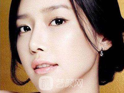 济南拉皮除皱提升需要多少钱?