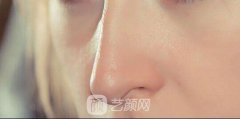 北京做修复鼻子需要多少钱？