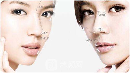 注射胶原蛋白隆鼻好吗?