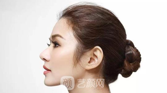 你有过觉得自己整形失败的时候吗？