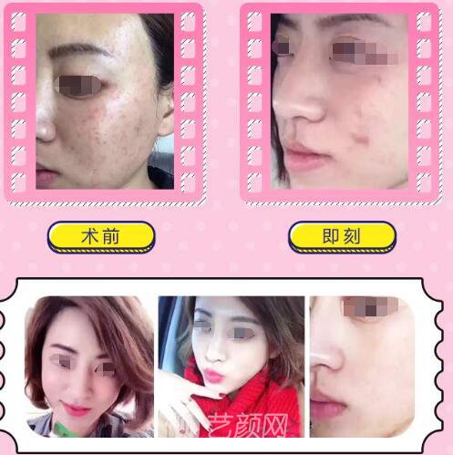 宿培龙医生案例