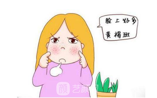 激光去除黄褐斑