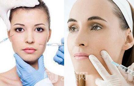 脸部减脂有副作用吗?脸部减脂副作用有哪些?