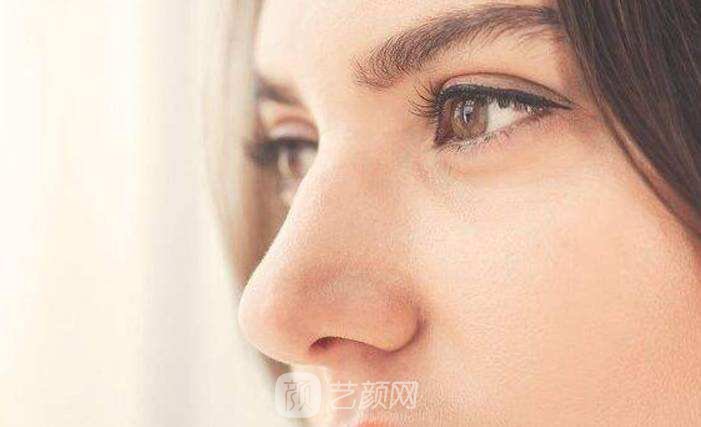 怎么能让鼻子变高变挺呢?