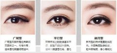 苏州内双割双眼皮多少钱？