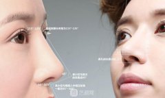 北京韩式肋骨隆鼻手术多少钱？