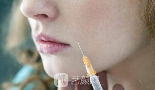 打注射瘦脸注射瘦脸大概多少钱?