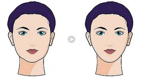 面部吸脂多久恢复正常？