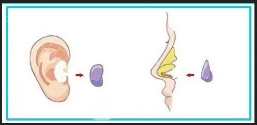 上海耳软骨垫鼻尖多少钱?