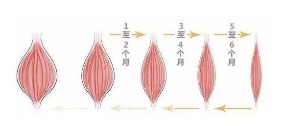 打注射瘦脸果怎么怎么样?维持多久?