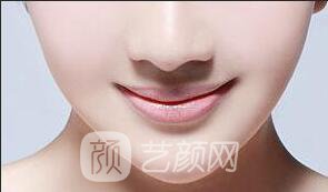 北京缩小鼻翼多少钱?