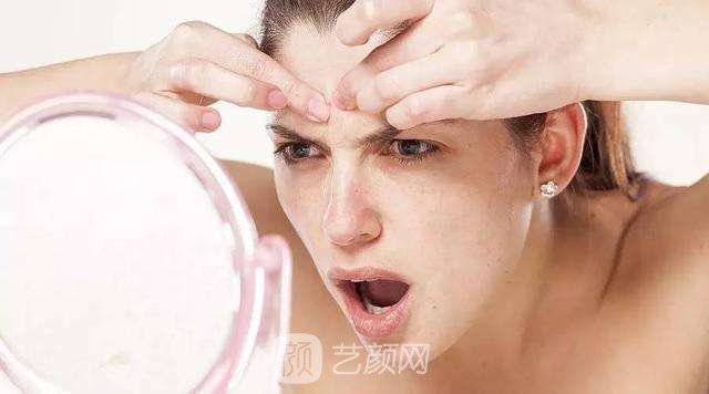 黄褐斑怎么去除果比较好?