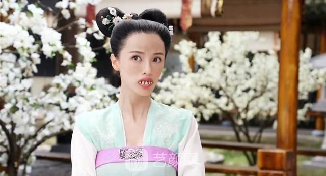 龅牙怎么矫正?果好吗?