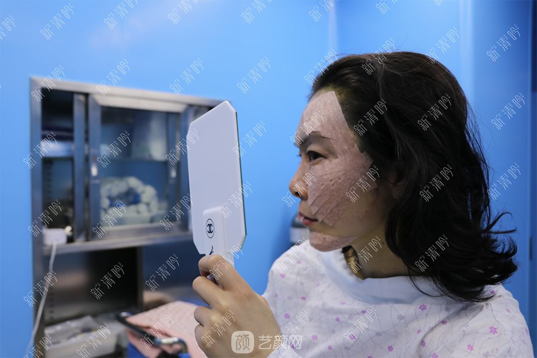 杭州新清吟陈永自体脂肪面部填充+注射瘦脸除皱案例直播~