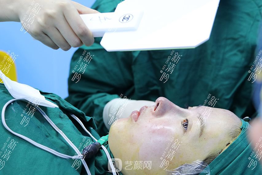 耳软骨隆鼻果图分享，术后~