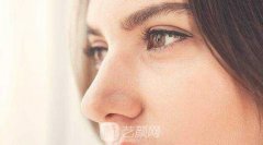 耳软骨隆鼻尖多少钱，收费贵不贵了?