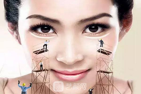 外切去眼袋果好吗?外切去眼袋果图~