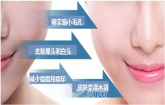 做一次黑脸娃娃需要多少钱?