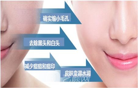 做一次黑脸娃娃需要多少钱?