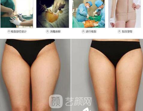 李东伟医生案例