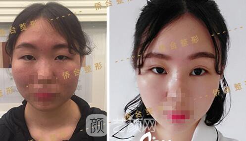 吴聃院长案例