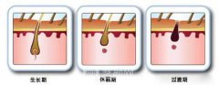 南宁激光脱毛大概多少钱？