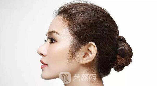 自体脂肪填充隆鼻果是*的吗?