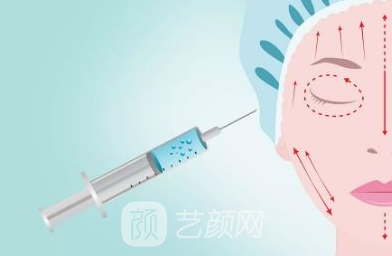艺颜网玻尿酸注射的费用一览表