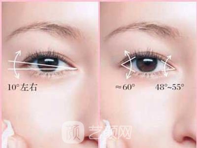 开眼角有危险吗?没问题吗?