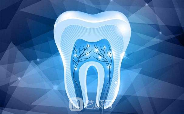 做假牙好还是种植牙好