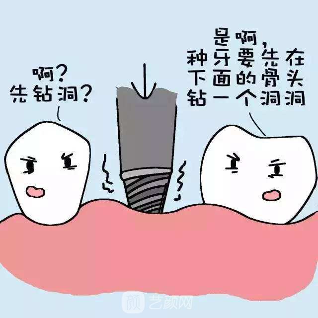 做假牙好还是种植牙好