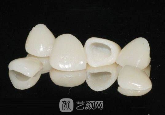 烤瓷牙好还是植牙好