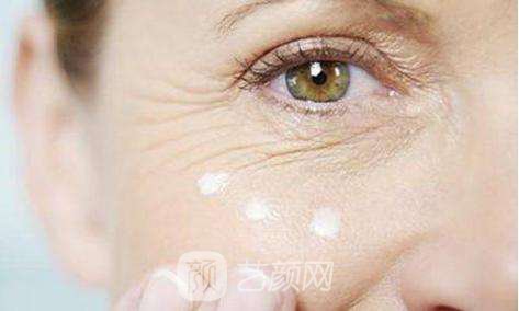 注射去鱼尾纹果图,注射去鱼尾纹果如何?