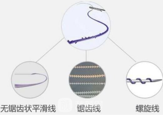 【上下眼睑提升手术果好吗？上下眼睑提升手术果图~】