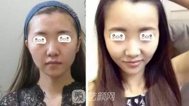 杨涛主任案例