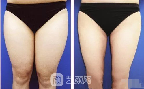 胡小晗医生案例