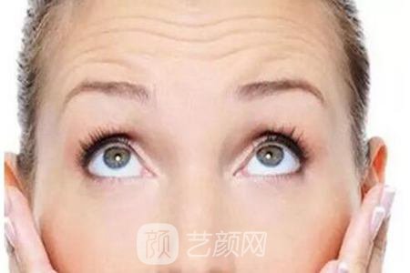 微晶瓷去抬头纹多少钱?