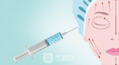 脂肪丰太阳穴需要多少钱?