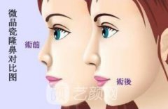 整形去哪儿好?艺颜整形网为你提供优质的整形服务