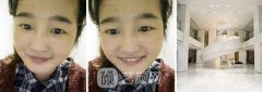 明眸翘睫双眼皮图 真人实例